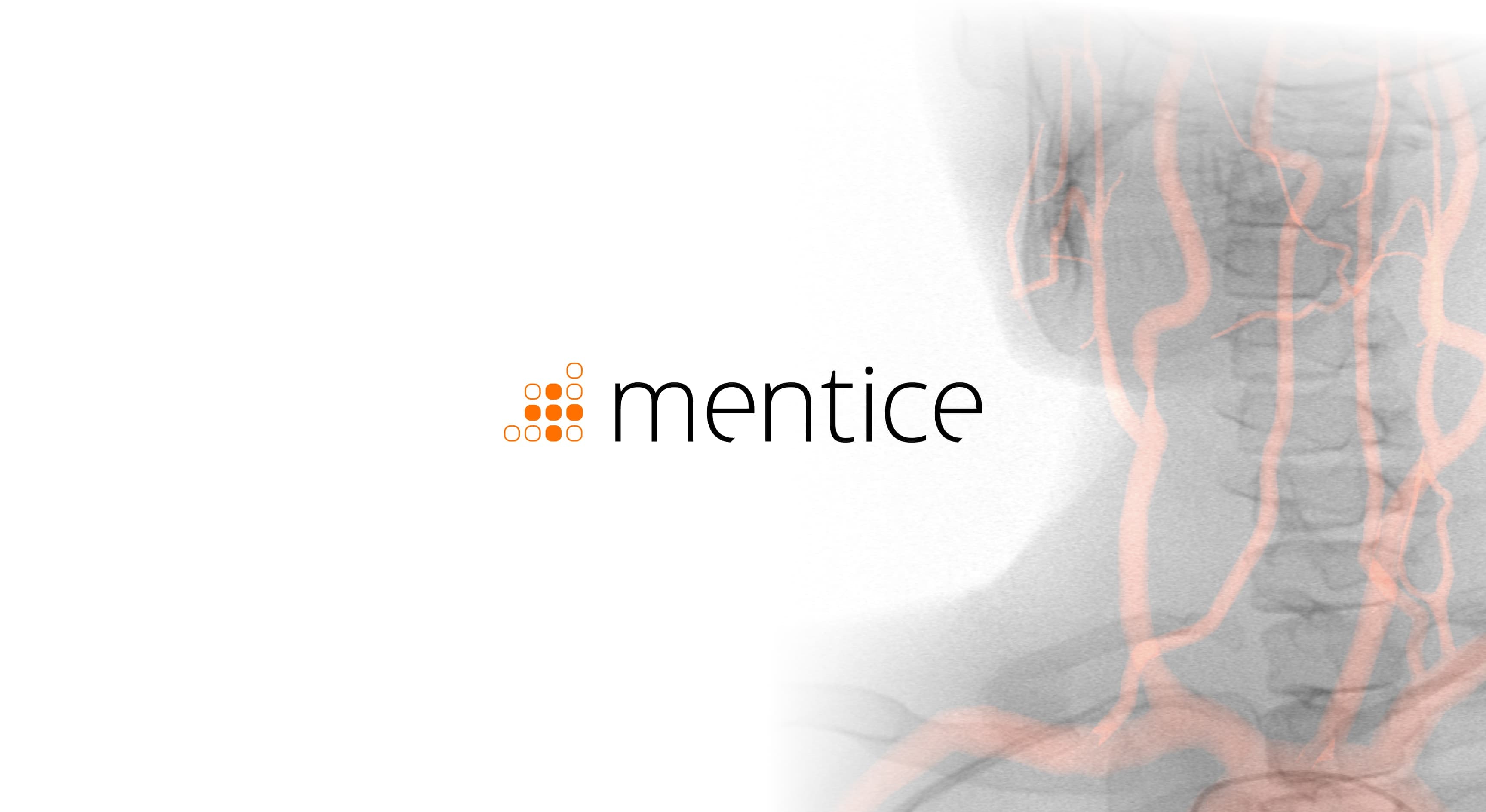 Mentice